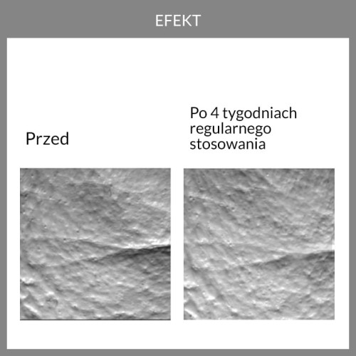 Badania aparaturowe, potwierdzające wygładzający efekt regularnego stosowania serum już po 4 tygodniach