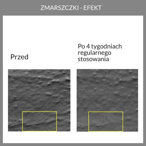 Potwierdzona skuteczność. Wyniki badań aparaturowych kremu anti-aging z opuncją figową 5.6 face the future