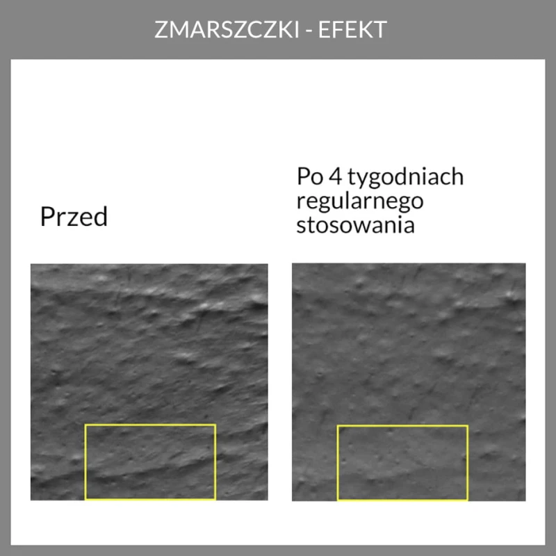 Potwierdzona skuteczność. Wyniki badań aparaturowych kremu anti-aging z opuncją figową 5.6 face the future