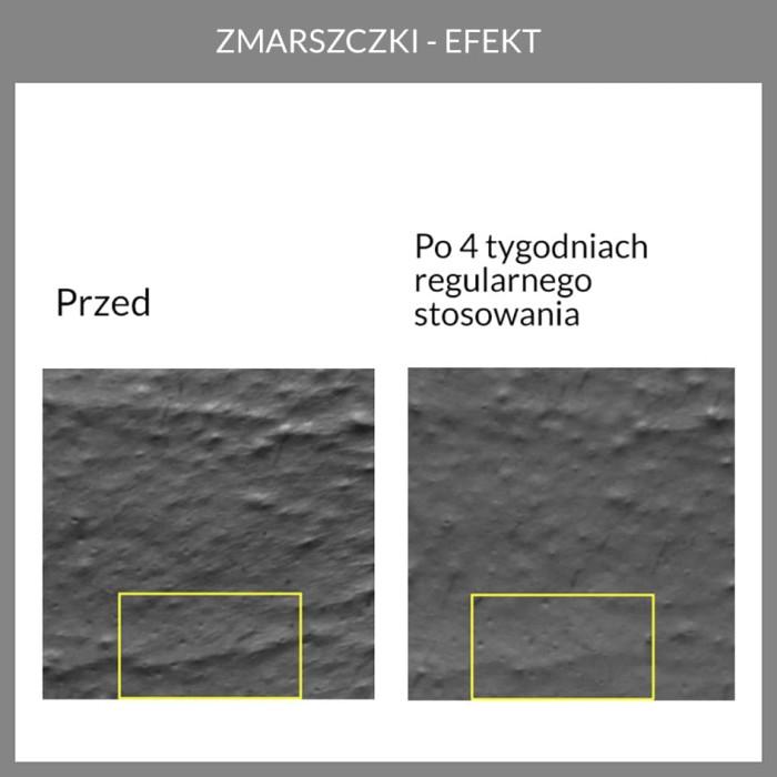 Potwierdzona skuteczność. Wyniki badań aparaturowych kremu anti-aging z opuncją figową 5.6 face the future