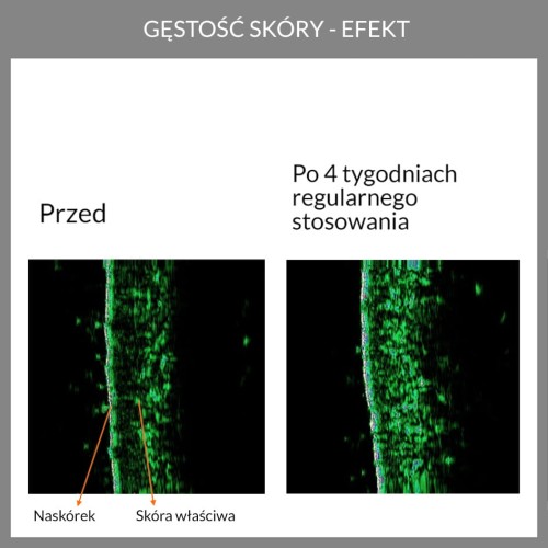 Potwierdzona skuteczność. Wyniki badań aparaturowych kremu anti-aging z opuncją figową 5.6 face the future
