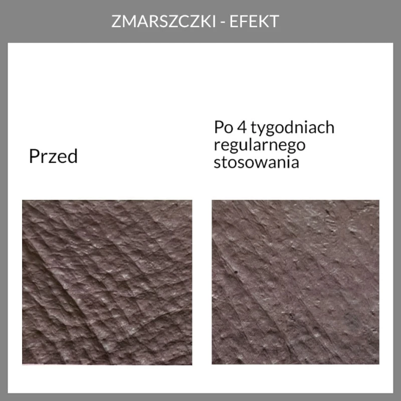 Potwierdzona skuteczność. wyniki badań aparaturowych kremu przeciwzmarszczkowego 1.1 face the cream