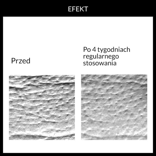 Potwierdzona skuteczność. wyniki badań aparaturowych rewitalizującego kremu Fridge 1.9 serum bomb