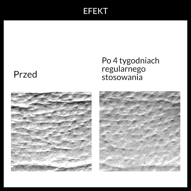 Potwierdzona skuteczność. wyniki badań aparaturowych rewitalizującego kremu Fridge 1.9 serum bomb